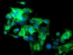 SLA2 Antibody in Immunocytochemistry (ICC/IF)