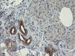 SLA2 Antibody in Immunohistochemistry (Paraffin) (IHC (P))