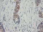 SLA2 Antibody in Immunohistochemistry (Paraffin) (IHC (P))