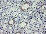 SLA2 Antibody in Immunohistochemistry (Paraffin) (IHC (P))