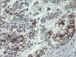 SLA2 Antibody in Immunohistochemistry (Paraffin) (IHC (P))