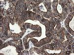 SLA2 Antibody in Immunohistochemistry (Paraffin) (IHC (P))