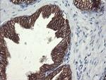 SLA2 Antibody in Immunohistochemistry (Paraffin) (IHC (P))