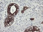 SLA2 Antibody in Immunohistochemistry (Paraffin) (IHC (P))