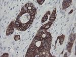 SLA2 Antibody in Immunohistochemistry (Paraffin) (IHC (P))