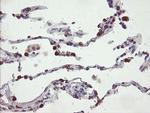 SLA2 Antibody in Immunohistochemistry (Paraffin) (IHC (P))