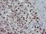 SLA2 Antibody in Immunohistochemistry (Paraffin) (IHC (P))