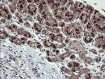 SLA2 Antibody in Immunohistochemistry (Paraffin) (IHC (P))