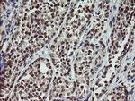 SLA2 Antibody in Immunohistochemistry (Paraffin) (IHC (P))