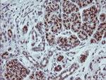 SLA2 Antibody in Immunohistochemistry (Paraffin) (IHC (P))