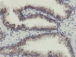 SLA2 Antibody in Immunohistochemistry (Paraffin) (IHC (P))