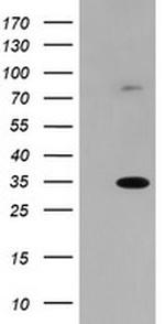 SLA2 Antibody in Western Blot (WB)