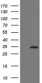 SLA2 Antibody in Western Blot (WB)