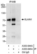 SLAIN1 Antibody in Immunoprecipitation (IP)