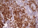 SLAMF7 Antibody in Immunohistochemistry (Paraffin) (IHC (P))