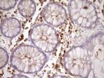 SLAMF7 Antibody in Immunohistochemistry (Paraffin) (IHC (P))