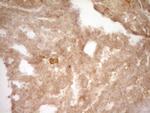 SLAMF7 Antibody in Immunohistochemistry (Paraffin) (IHC (P))