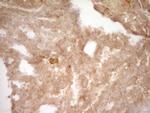 SLAMF7 Antibody in Immunohistochemistry (Paraffin) (IHC (P))