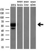 SLC18A2 Antibody in Western Blot (WB)