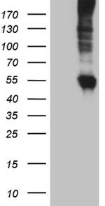 SLC22A17 Antibody in Western Blot (WB)