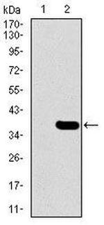 SLC27A5 Antibody in Western Blot (WB)