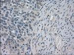 SLC2A5 Antibody in Immunohistochemistry (Paraffin) (IHC (P))