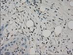 SLC2A5 Antibody in Immunohistochemistry (Paraffin) (IHC (P))