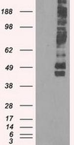 SLC2A5 Antibody in Western Blot (WB)