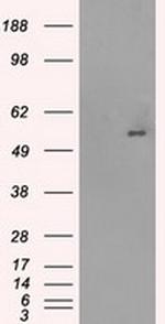 SLC2A5 Antibody in Western Blot (WB)