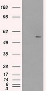 SLC2A5 Antibody in Western Blot (WB)