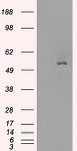 SLC2A5 Antibody in Western Blot (WB)