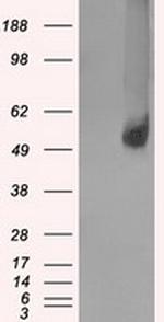 SLC2A5 Antibody in Western Blot (WB)