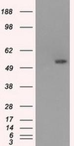 SLC2A5 Antibody in Western Blot (WB)