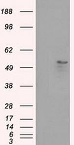 SLC2A5 Antibody in Western Blot (WB)