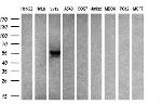 SLC2A5 Antibody in Western Blot (WB)