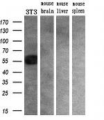 SLC2A6 Antibody in Western Blot (WB)