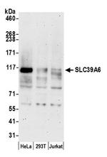 SLC39A6 Antibody in Western Blot (WB)