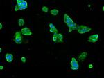 SLC7A8 Antibody in Immunocytochemistry (ICC/IF)