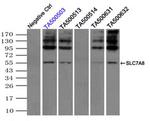 SLC7A8 Antibody in Immunoprecipitation (IP)