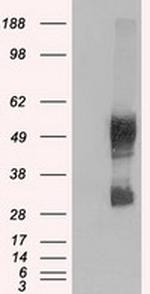 SLC7A8 Antibody in Western Blot (WB)