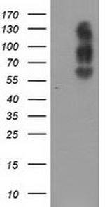 SLC7A8 Antibody in Western Blot (WB)