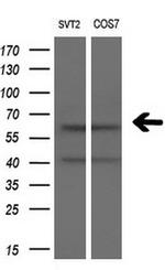 SLC7A8 Antibody in Western Blot (WB)