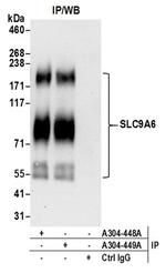 SLC9A6 Antibody in Western Blot (WB)