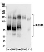 SLC9A6 Antibody in Western Blot (WB)