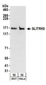 SLITRK5 Antibody in Western Blot (WB)