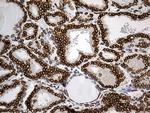 SLU7 Antibody in Immunohistochemistry (Paraffin) (IHC (P))