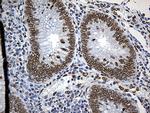 SLU7 Antibody in Immunohistochemistry (Paraffin) (IHC (P))