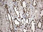 SLU7 Antibody in Immunohistochemistry (Paraffin) (IHC (P))