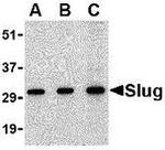 SLUG Antibody in Western Blot (WB)