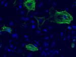 Alpha-Smooth Muscle Actin Antibody in Immunocytochemistry (ICC/IF)